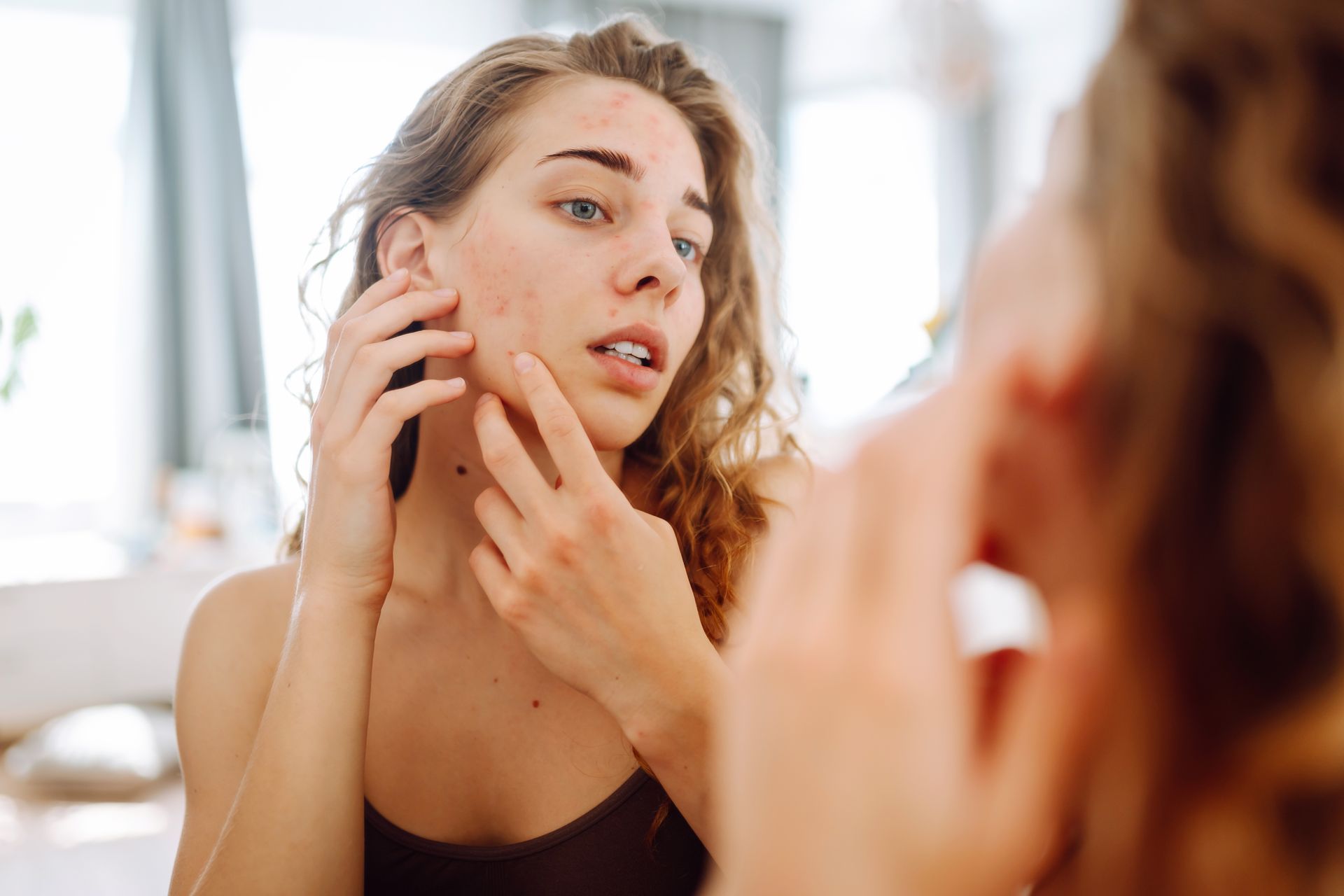Woman looking at face in mirror, concerned expression, touching skin with blemishes.