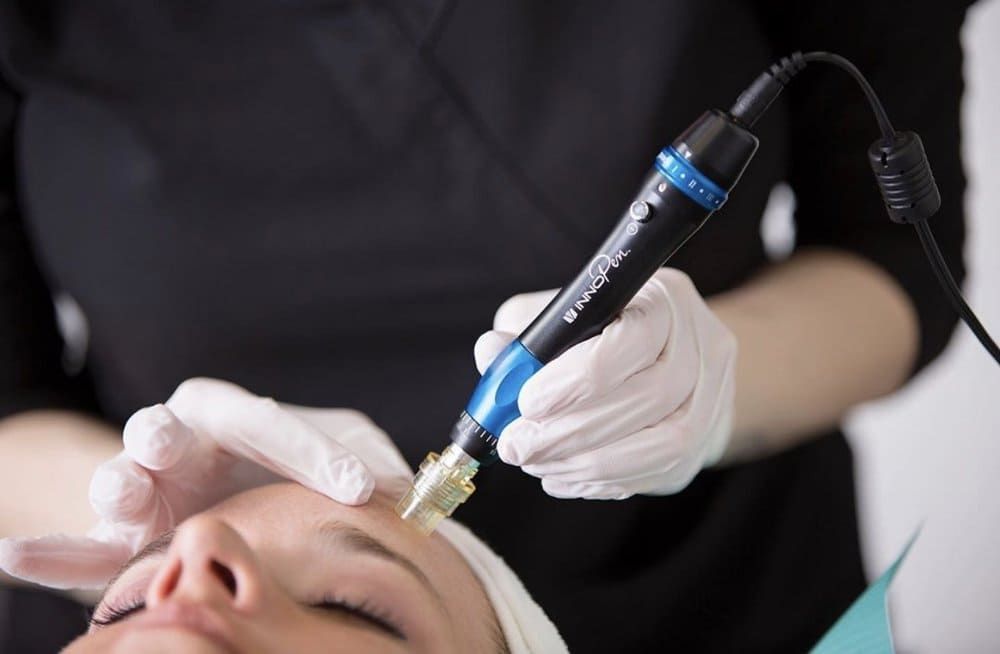 A woman is getting a microdermabrasion treatment on her face.