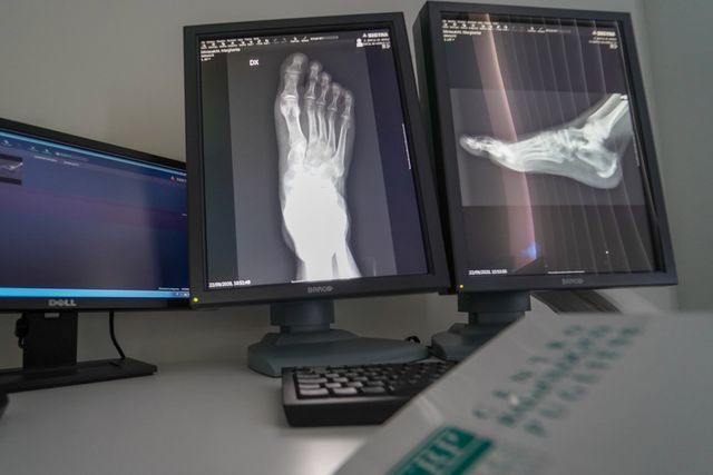 radiologia digitale