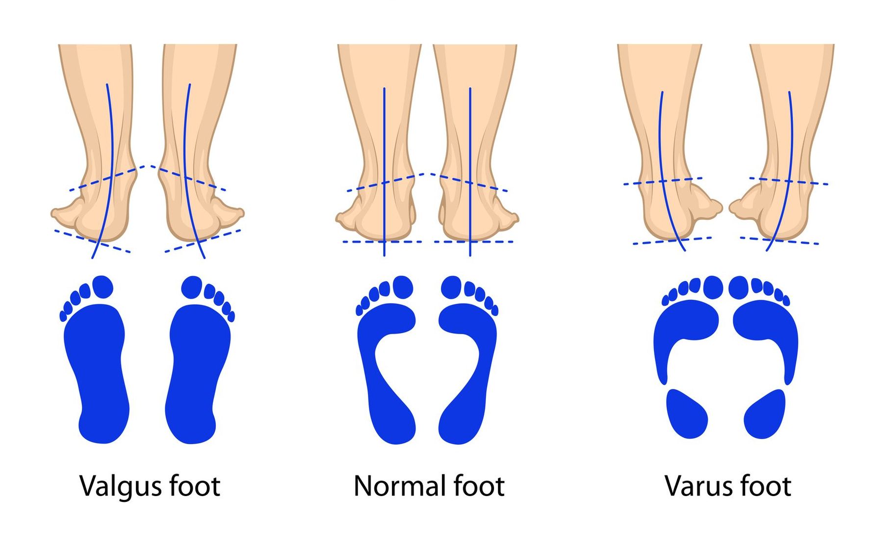 Trattamento delle deformità