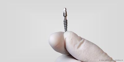 Minimalinvasive Implantation: Zierliche Implantate, die ohne Schneiden und Nähen eingesetzt werden.