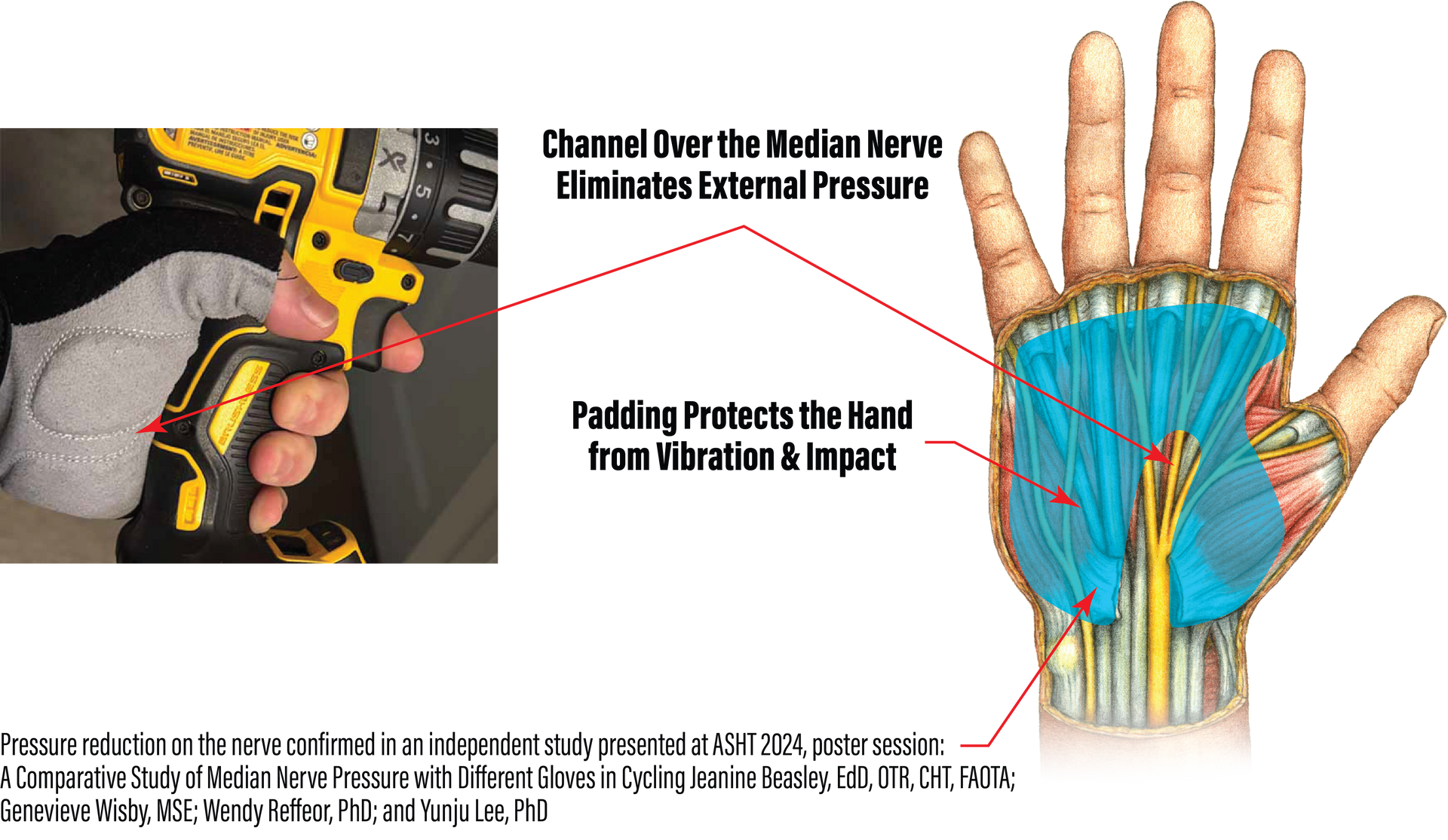 shocktek gloves, median nerve,  how it works, 