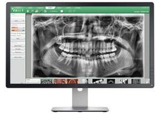 teeth xray