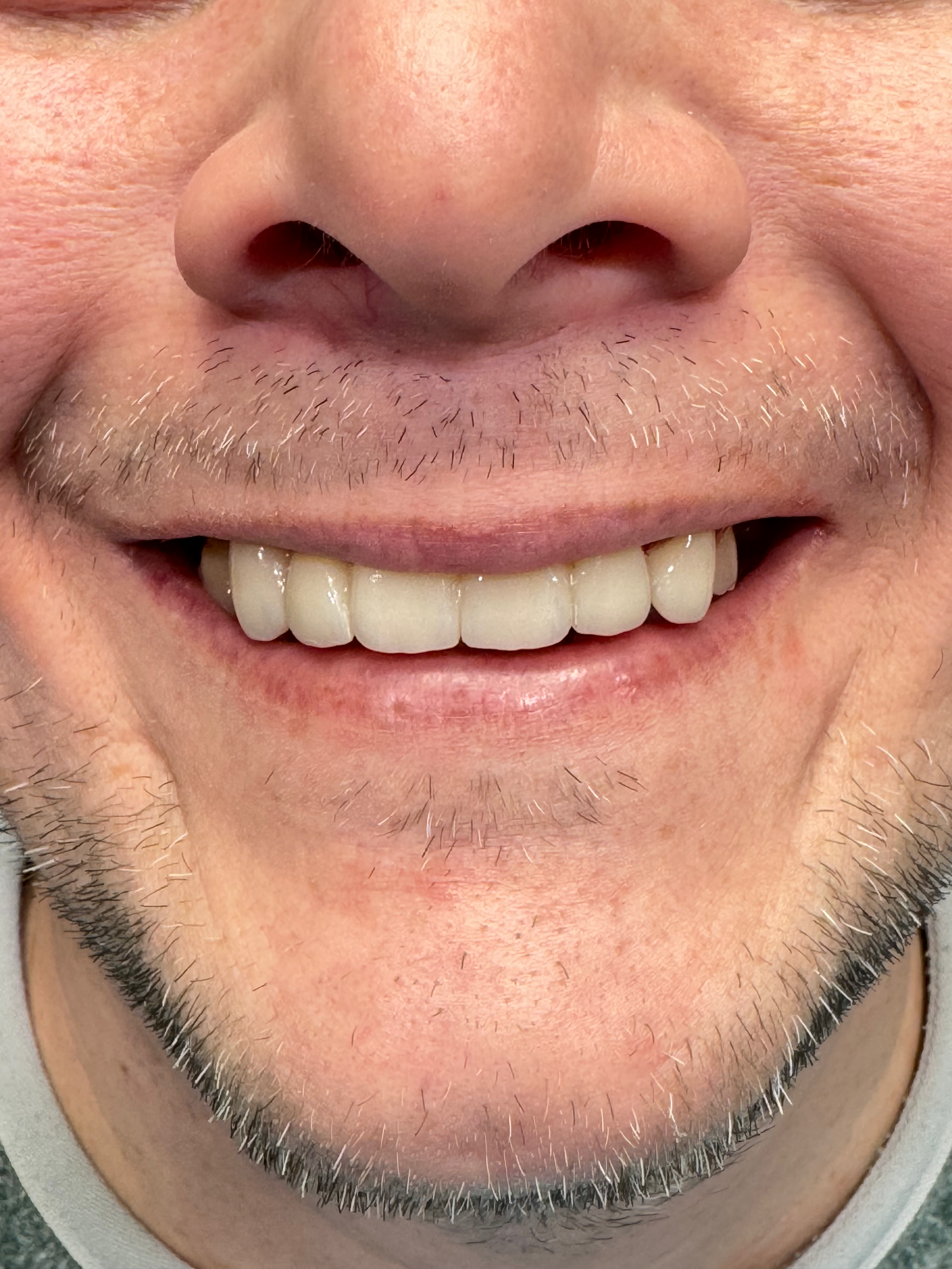 A close up of a man 's face with a beard and a smile.