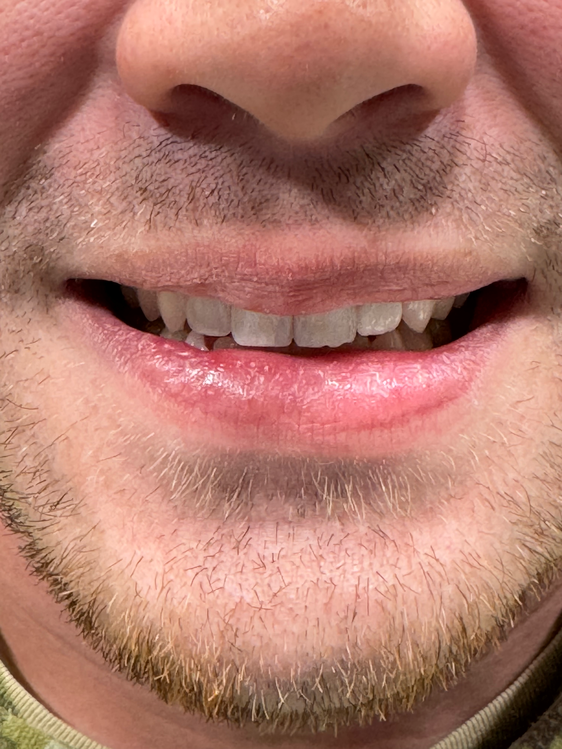 A close up of a man 's mouth with a beard and teeth.