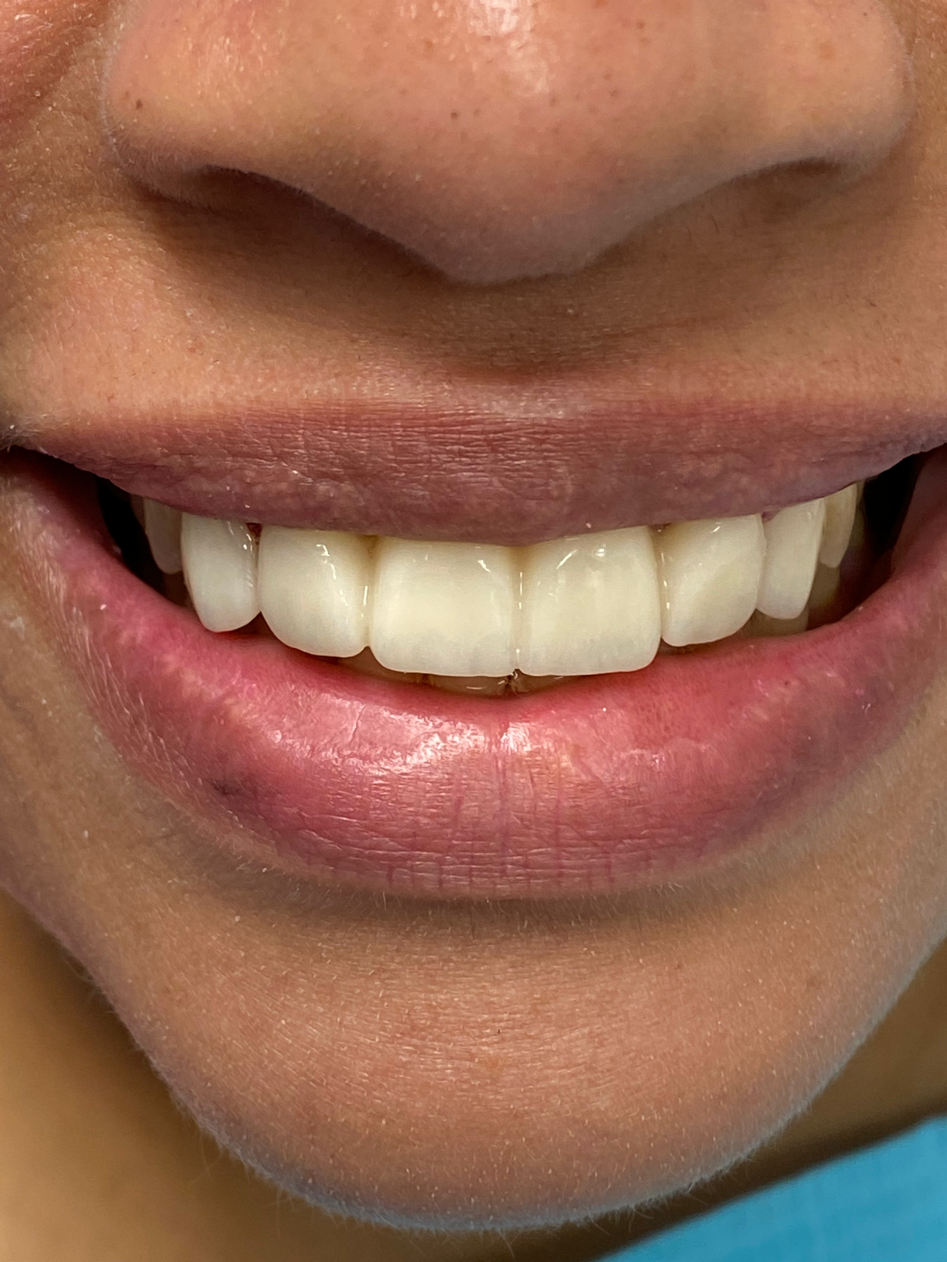 A close up of a woman 's mouth with white teeth and pink lips.