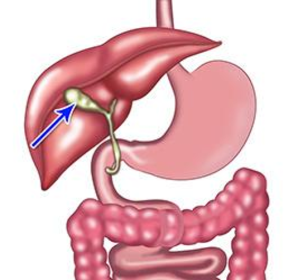 Sample photo of a gallbladder