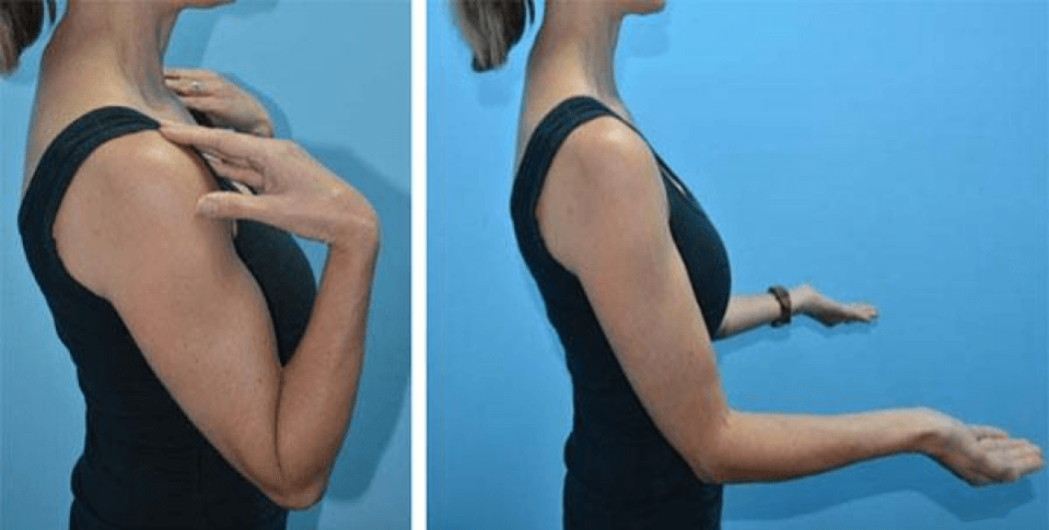Exercise showing elbow stretch