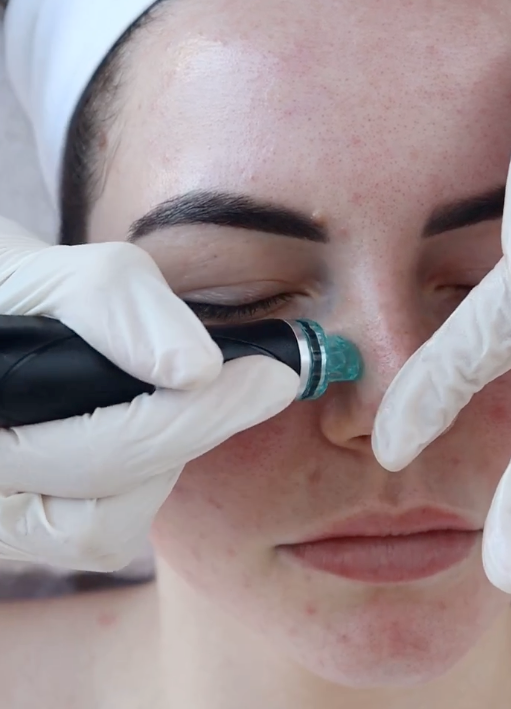 A Woman Is Getting a Facial Treatment at A Beauty Salon — Rejuved in Bateau Bay, NSW