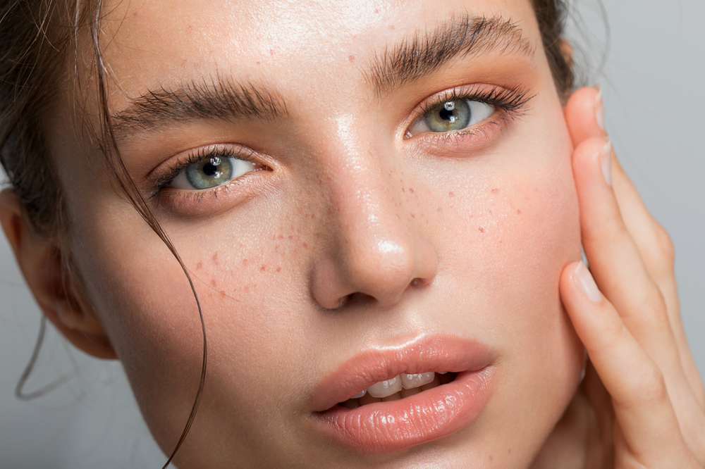 A Close up Of a Woman 's Face with Freckles — Rejuved in Bateau Bay, NSW