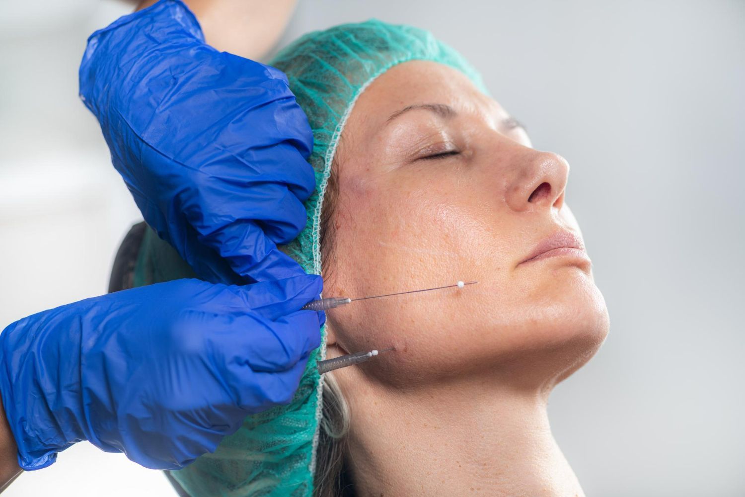 Person receiving facial cosmetic procedure, doctor's gloved hands holding needle near face.