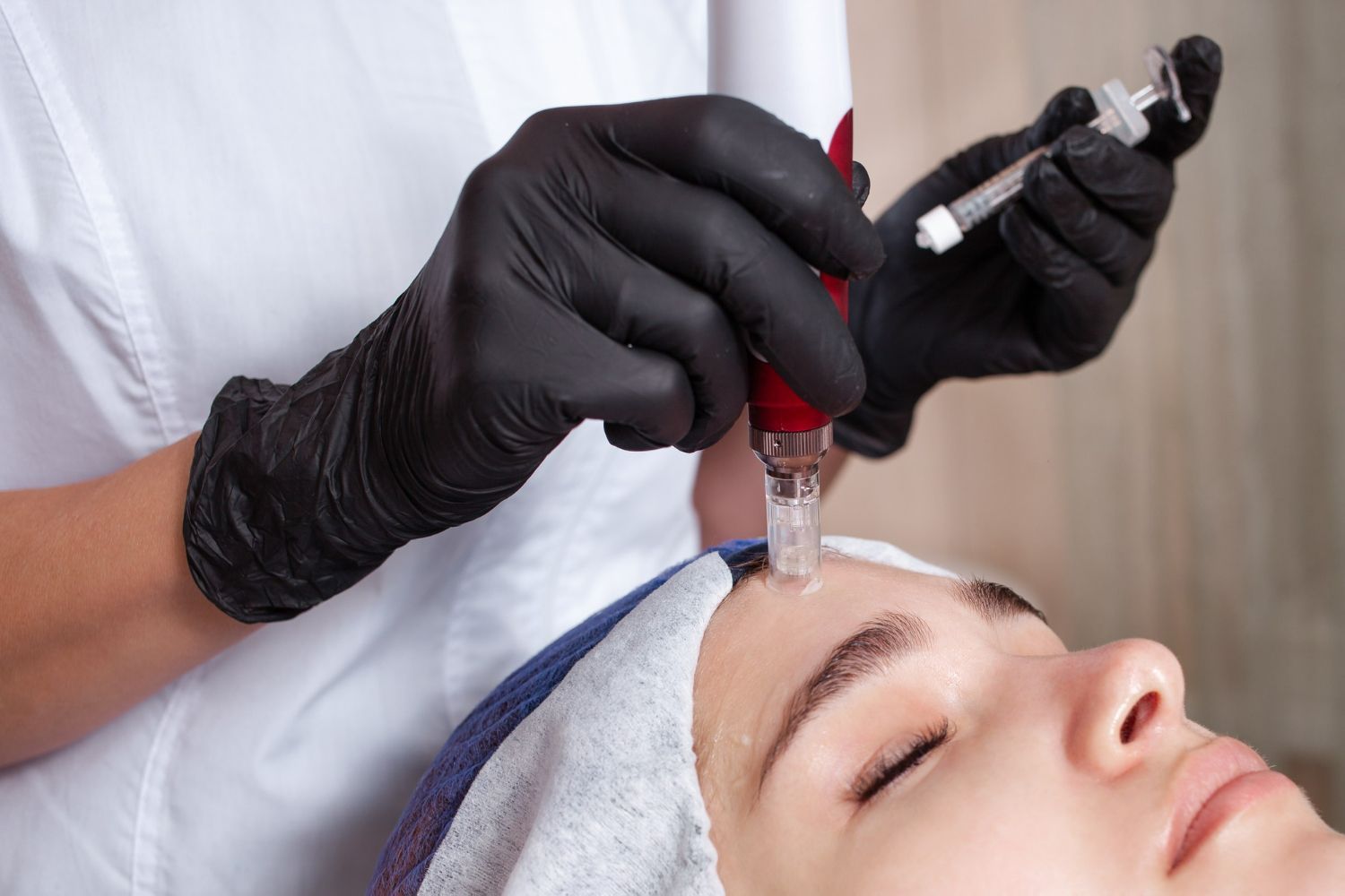Person receiving facial microneedling treatment. Black-gloved hands hold device over forehead.