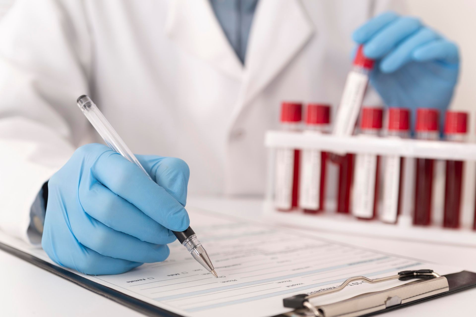 A doctor wearing blue gloves is writing on a clipboard.