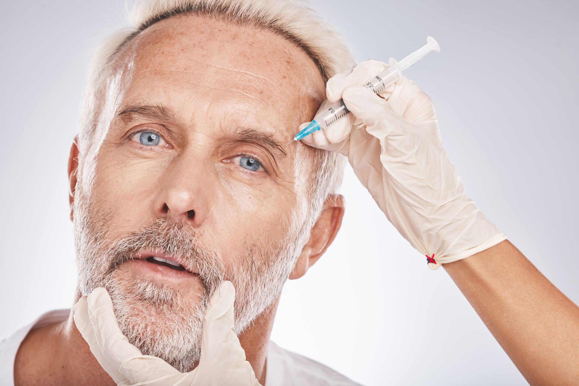 A man with a beard is getting a botox injection in his forehead.