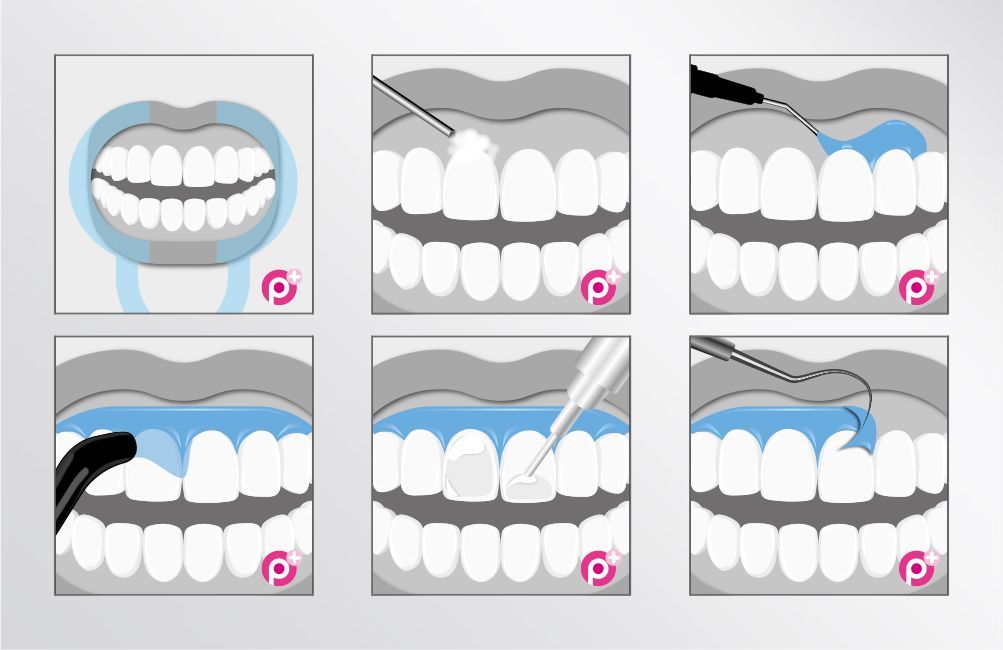 Instructional Illustrations, Dental, Southampton