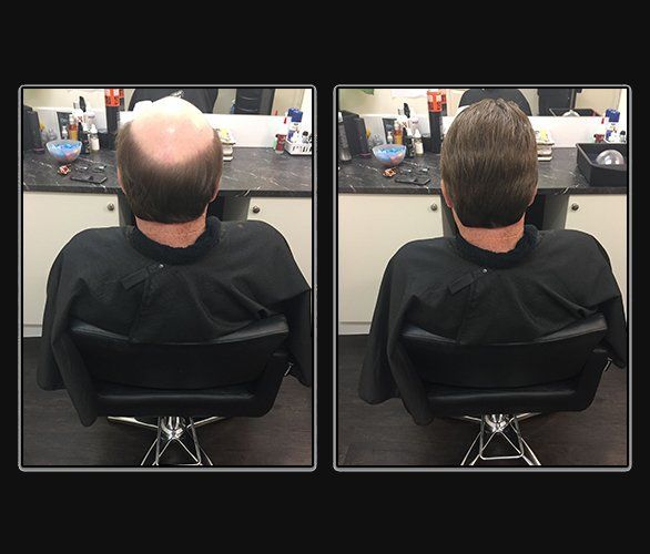 Before and After Hair System