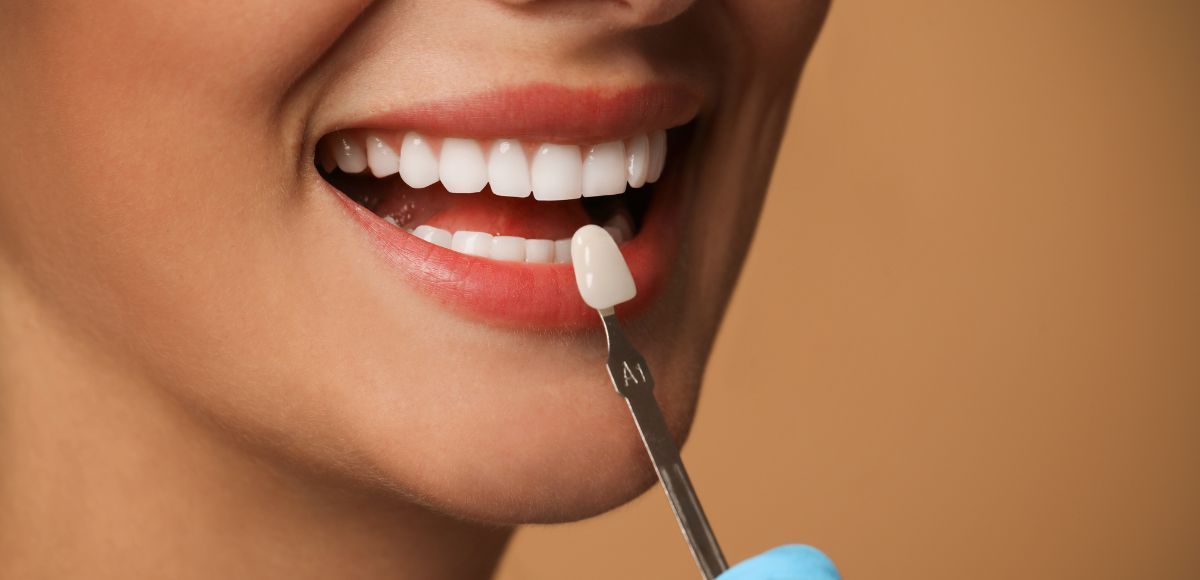 A person’s smiling mouth with a cotton swab applying white substance to a tooth