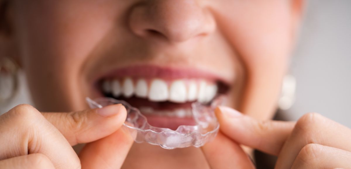 Person smiling while putting in a clear dental aligner