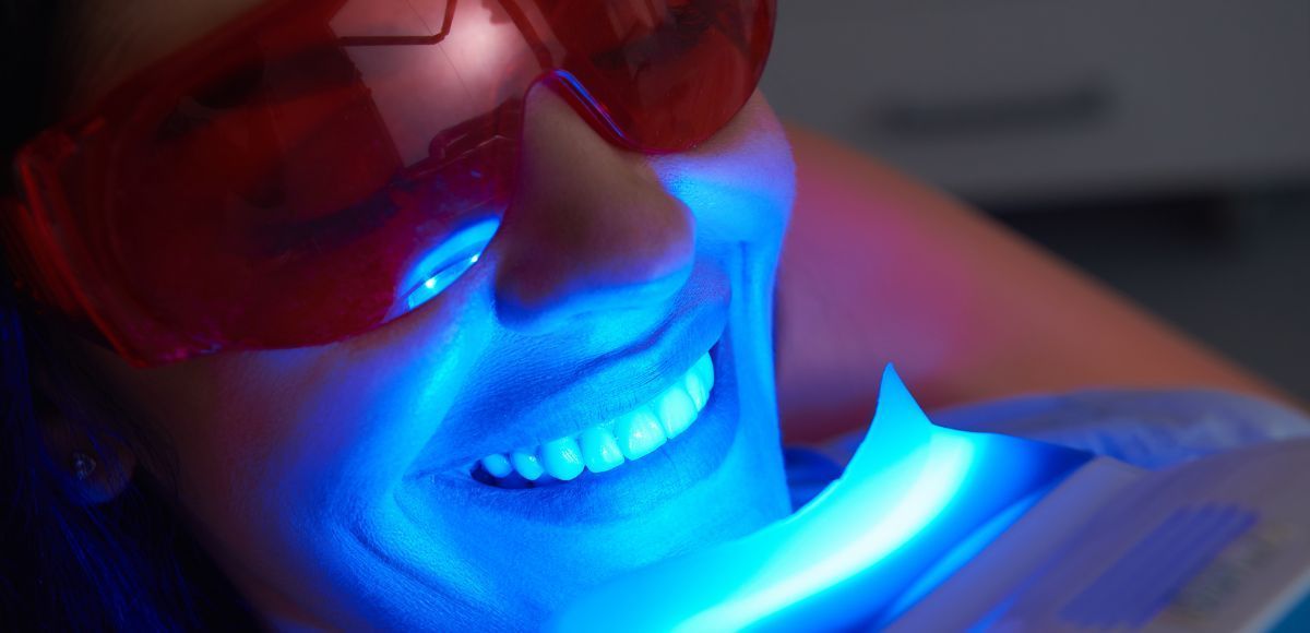 Person smiling during blue LED teeth-whitening treatment while wearing red protective glasses