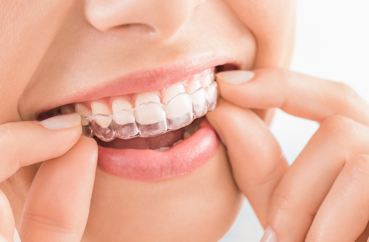 woman smiling while wearing invisalign retainres