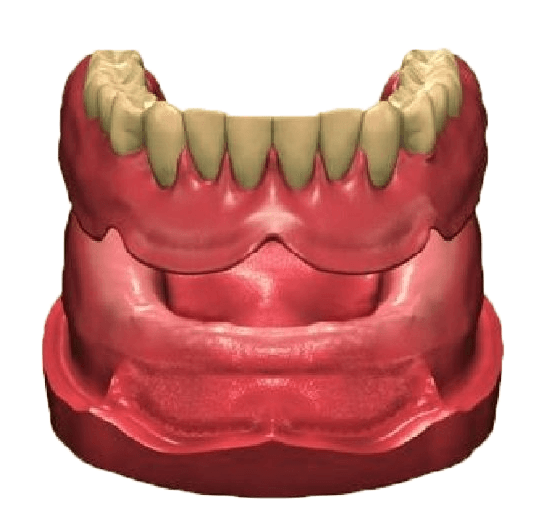 Prothèses dentaires; dents artificielles supérieures et inférieures, gencives roses, dents couleur ivoire; modèle dentaire.