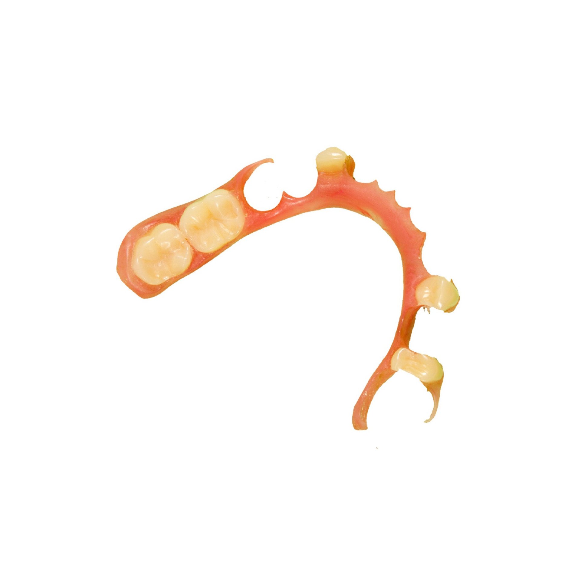 Prothèse partielle, rose et beige, avec dents de remplacement.