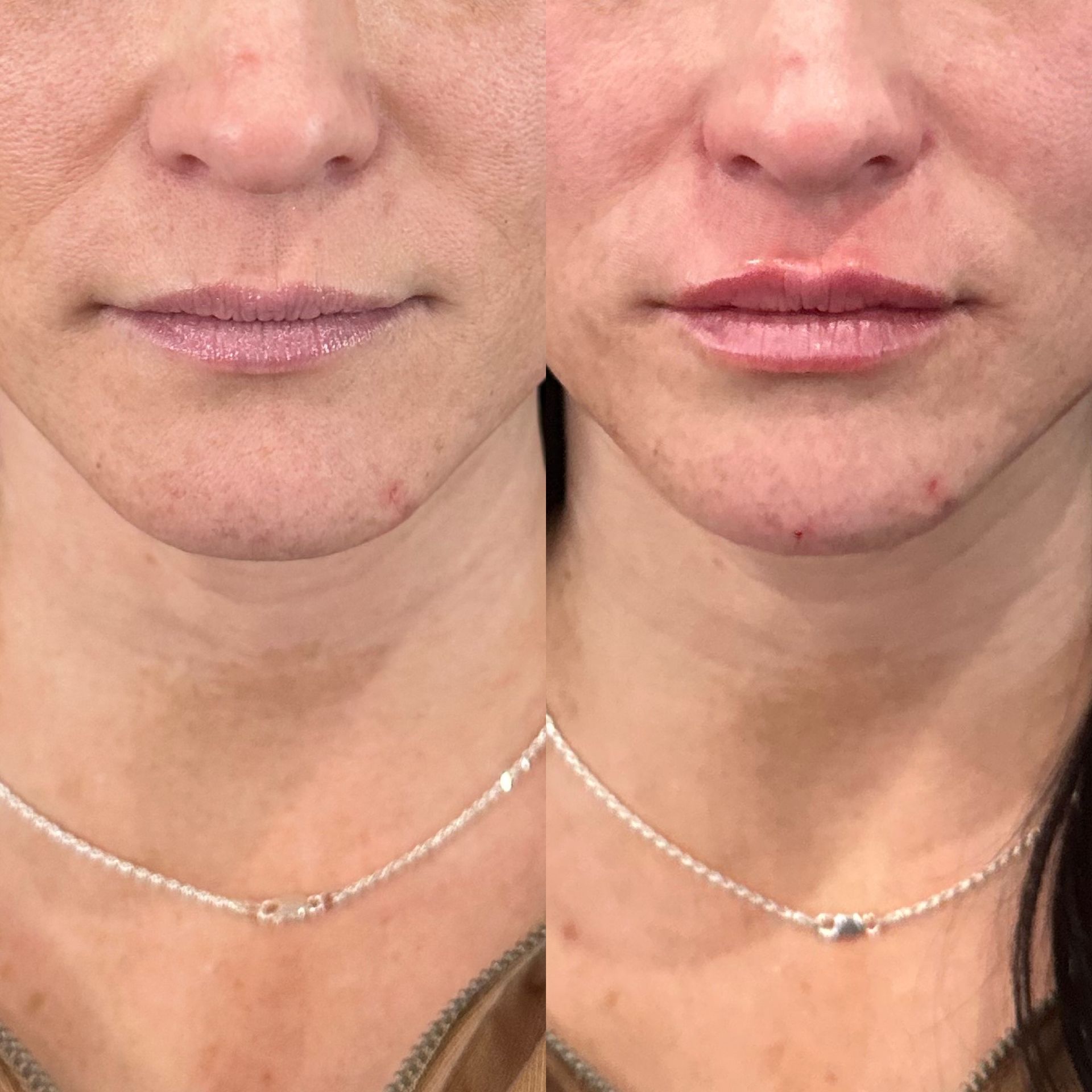 A before and after photo of a woman 's face with a necklace.