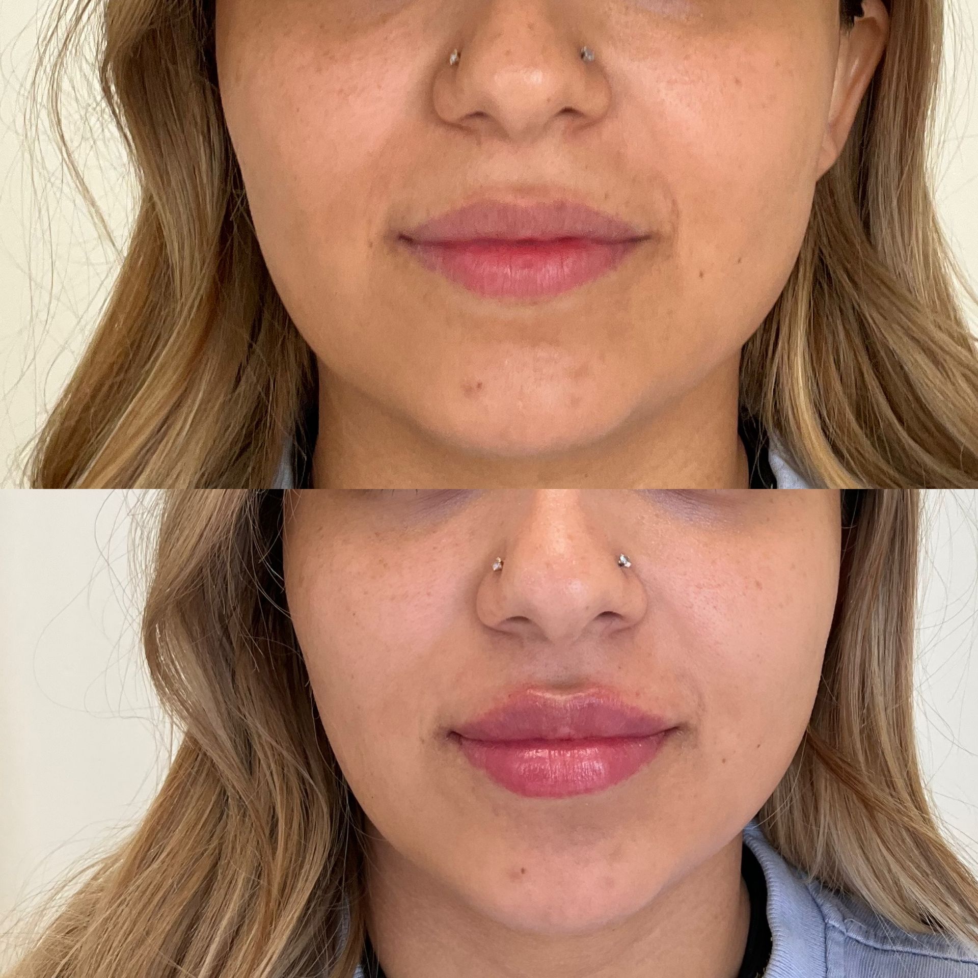 A before and after photo of a woman 's face