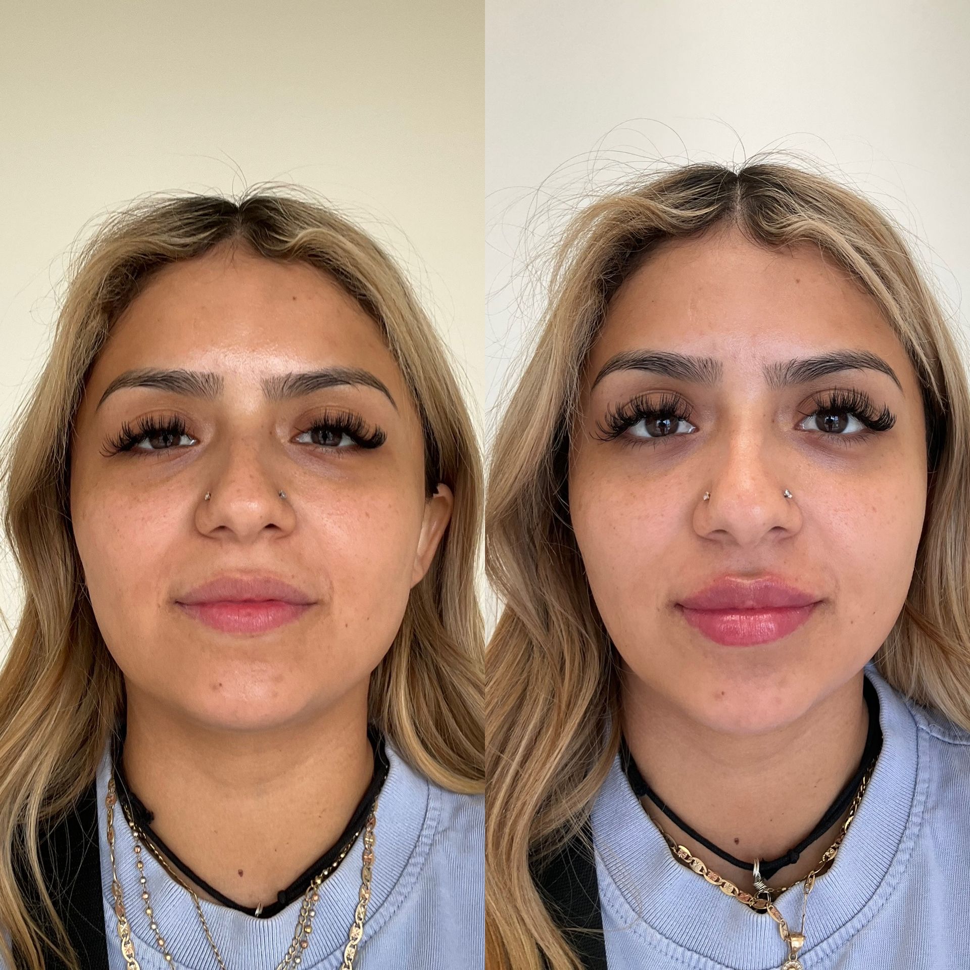A before and after photo of a woman 's face.