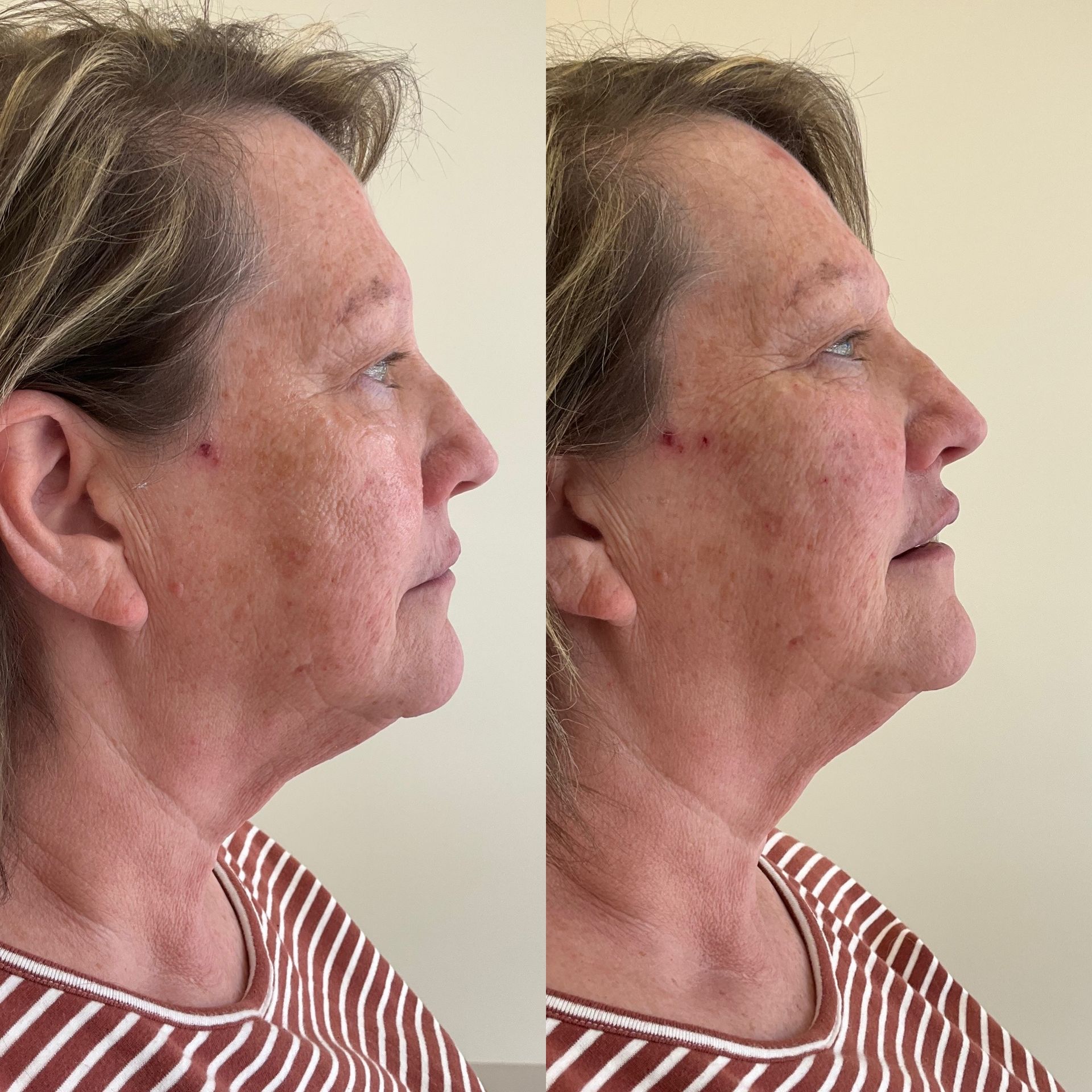 A before and after photo of a woman 's face