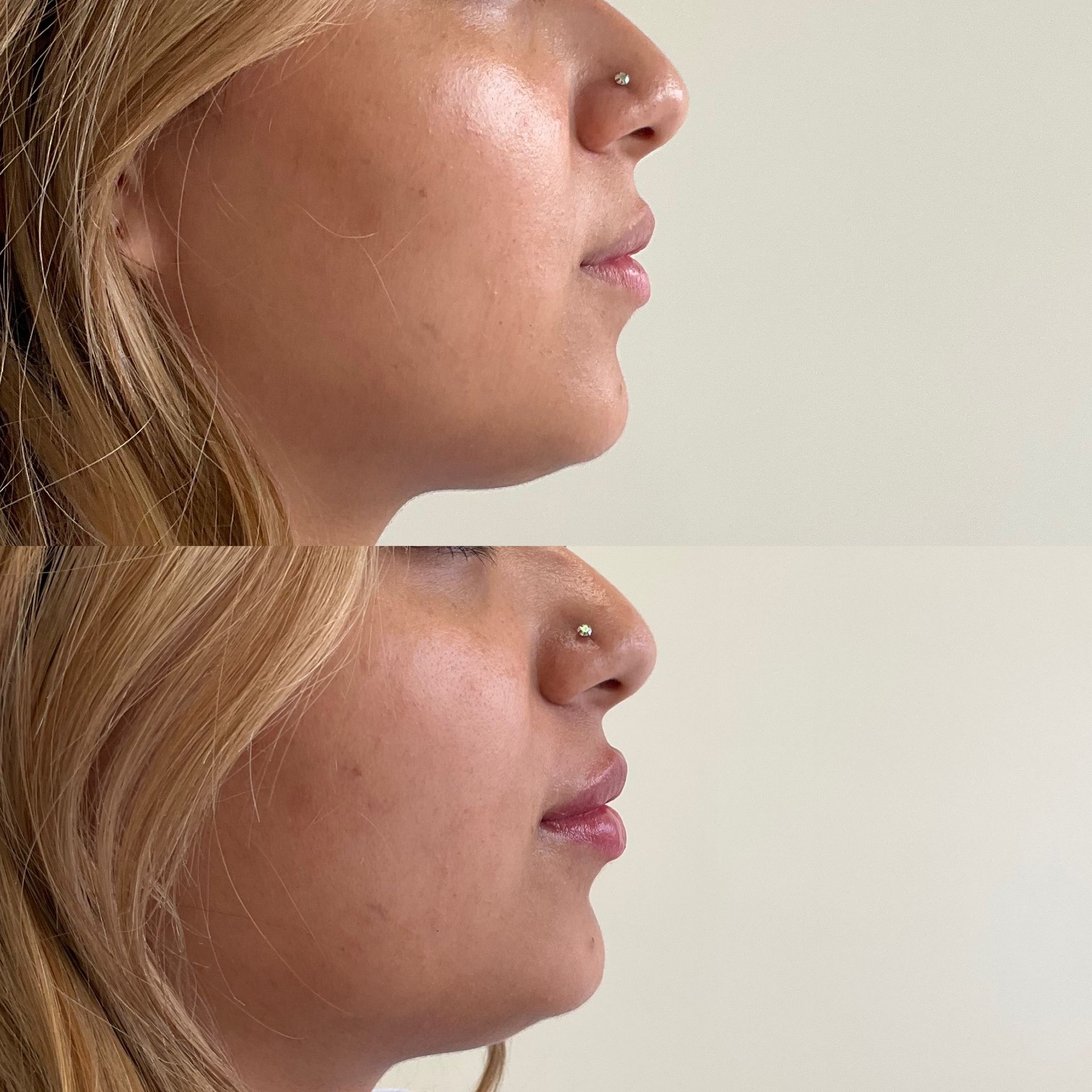 A before and after photo of a woman 's face