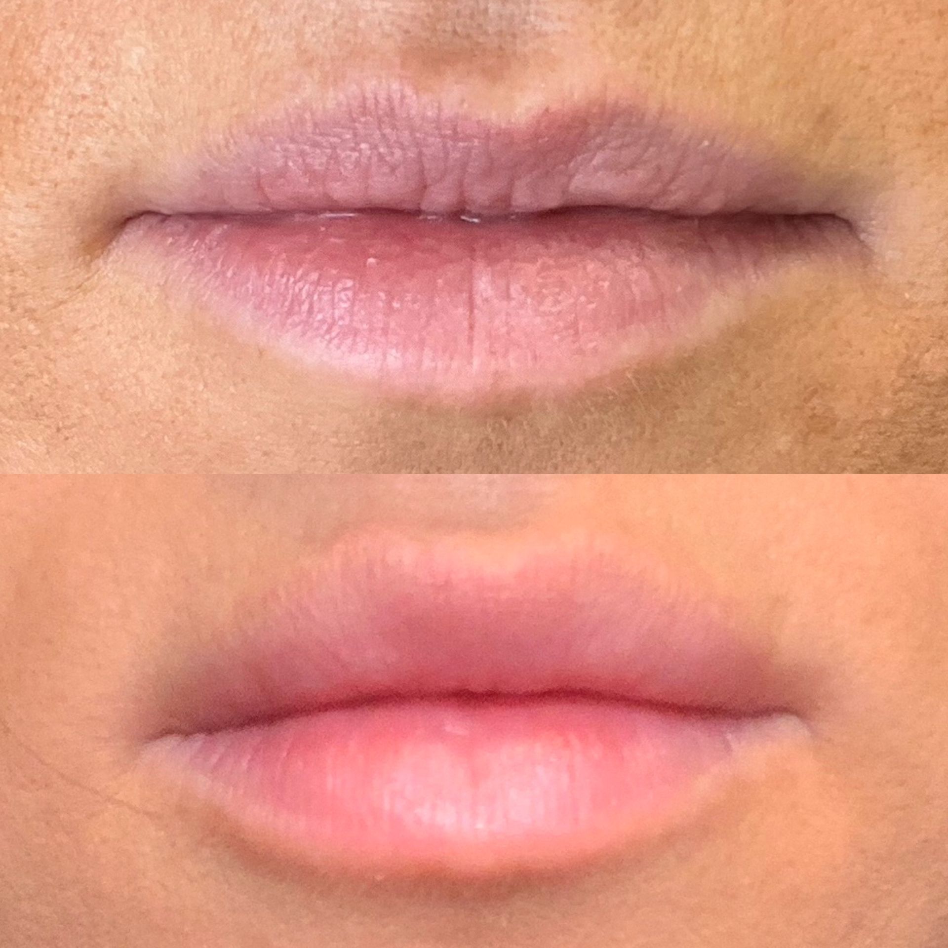 A before and after photo of a woman 's lips.