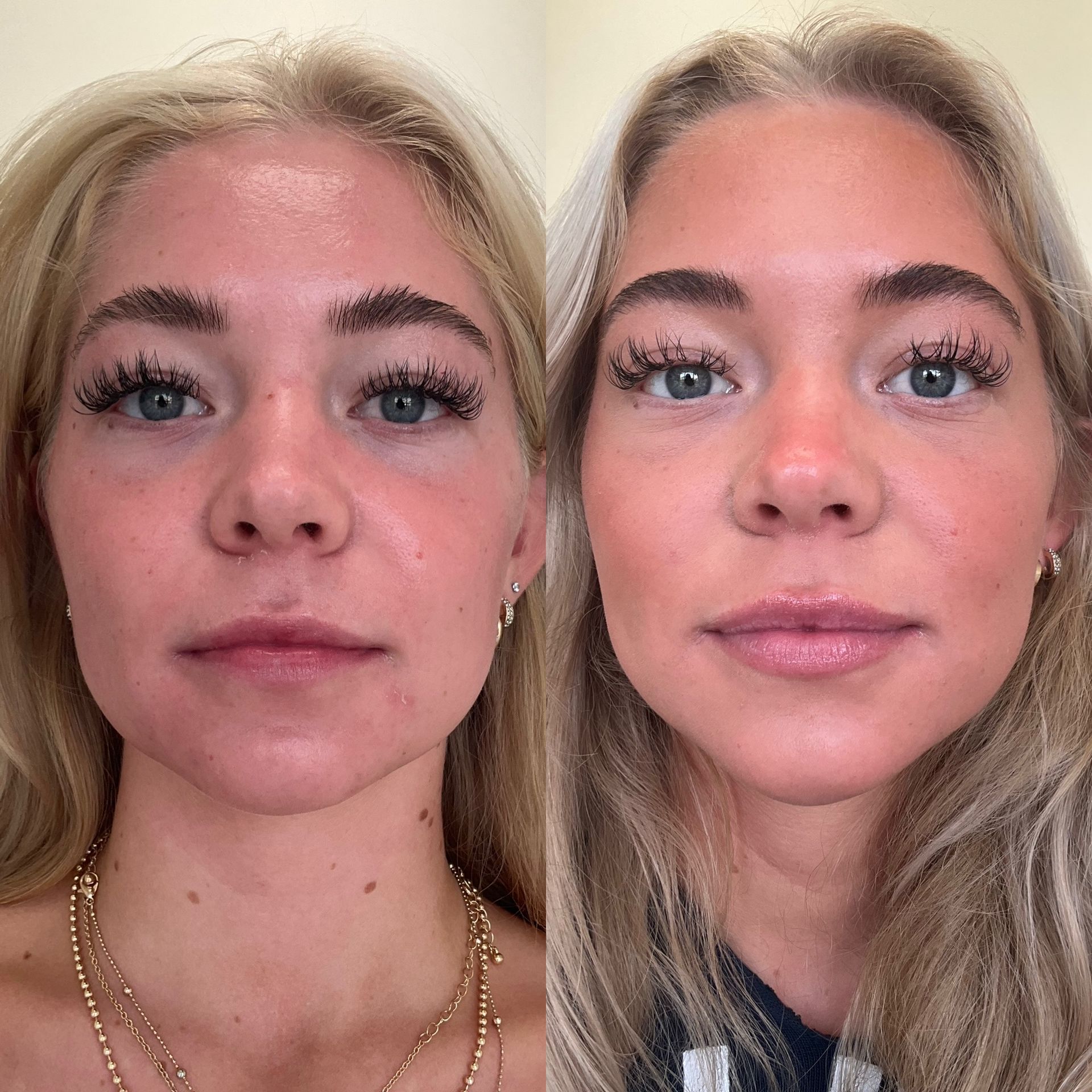 A before and after photo of a woman 's face