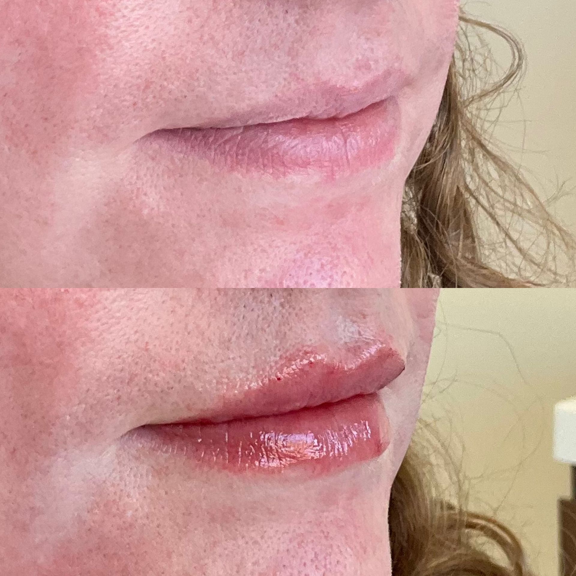 A before and after photo of a woman 's lips.