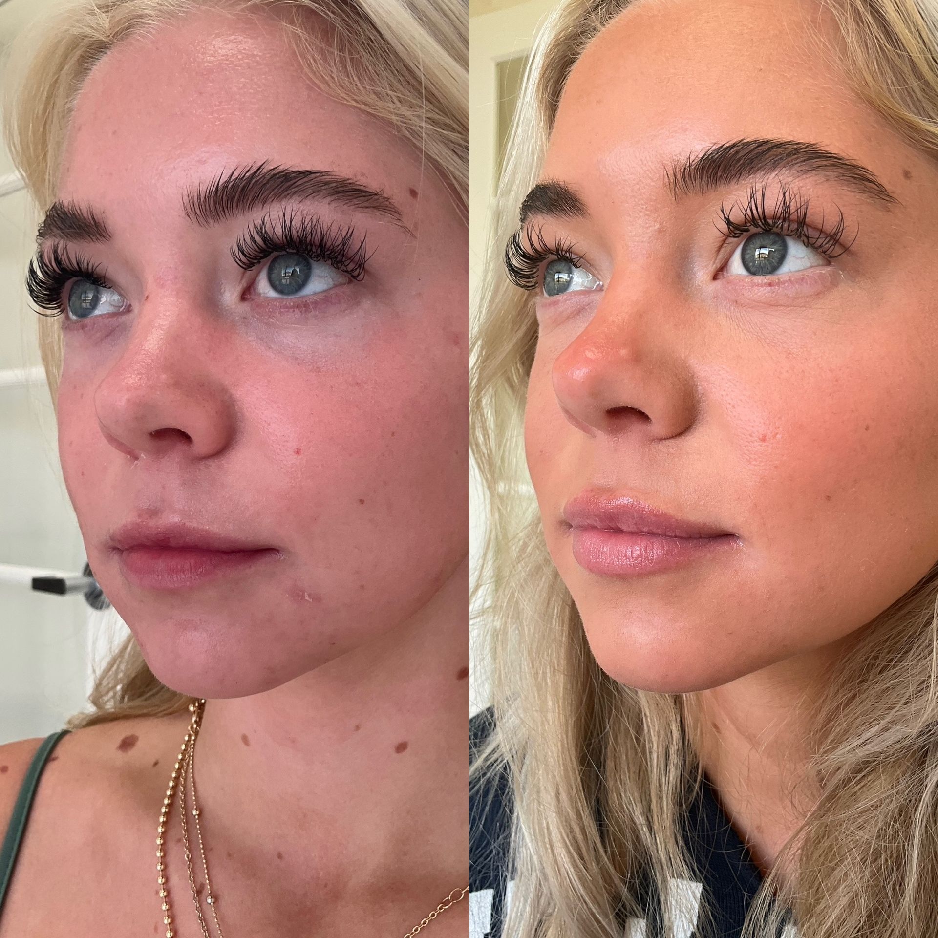 A before and after photo of a woman 's face.