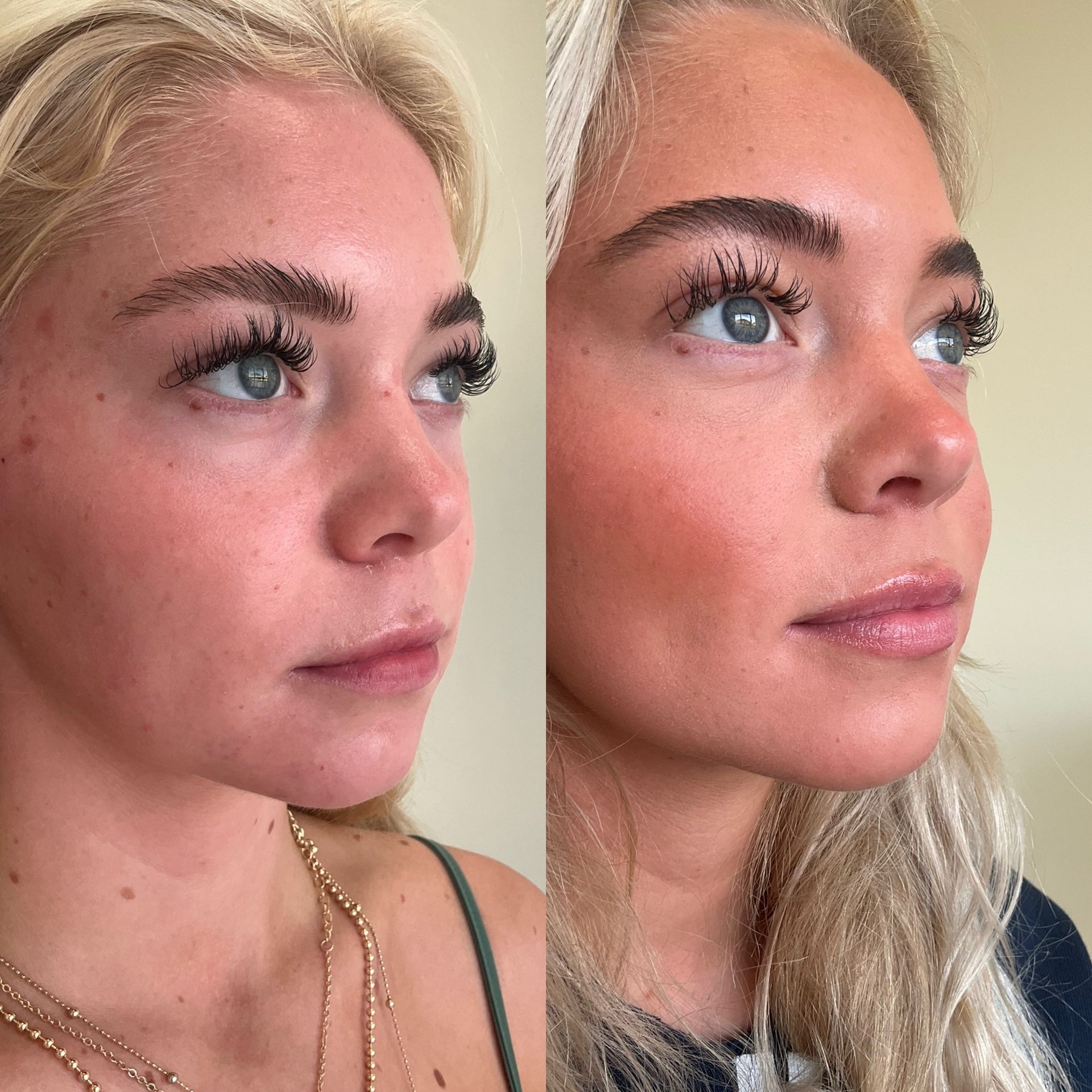 A before and after photo of a woman 's face