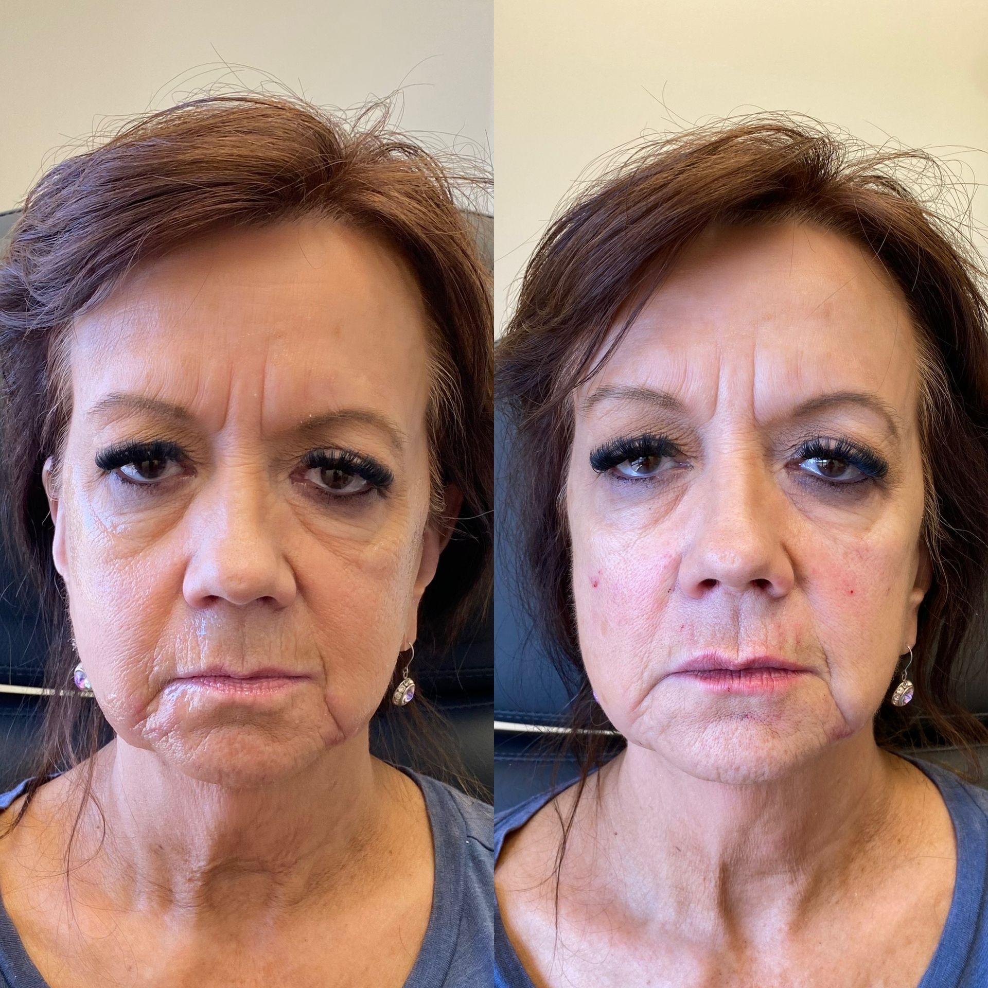 A before and after photo of a woman 's face.