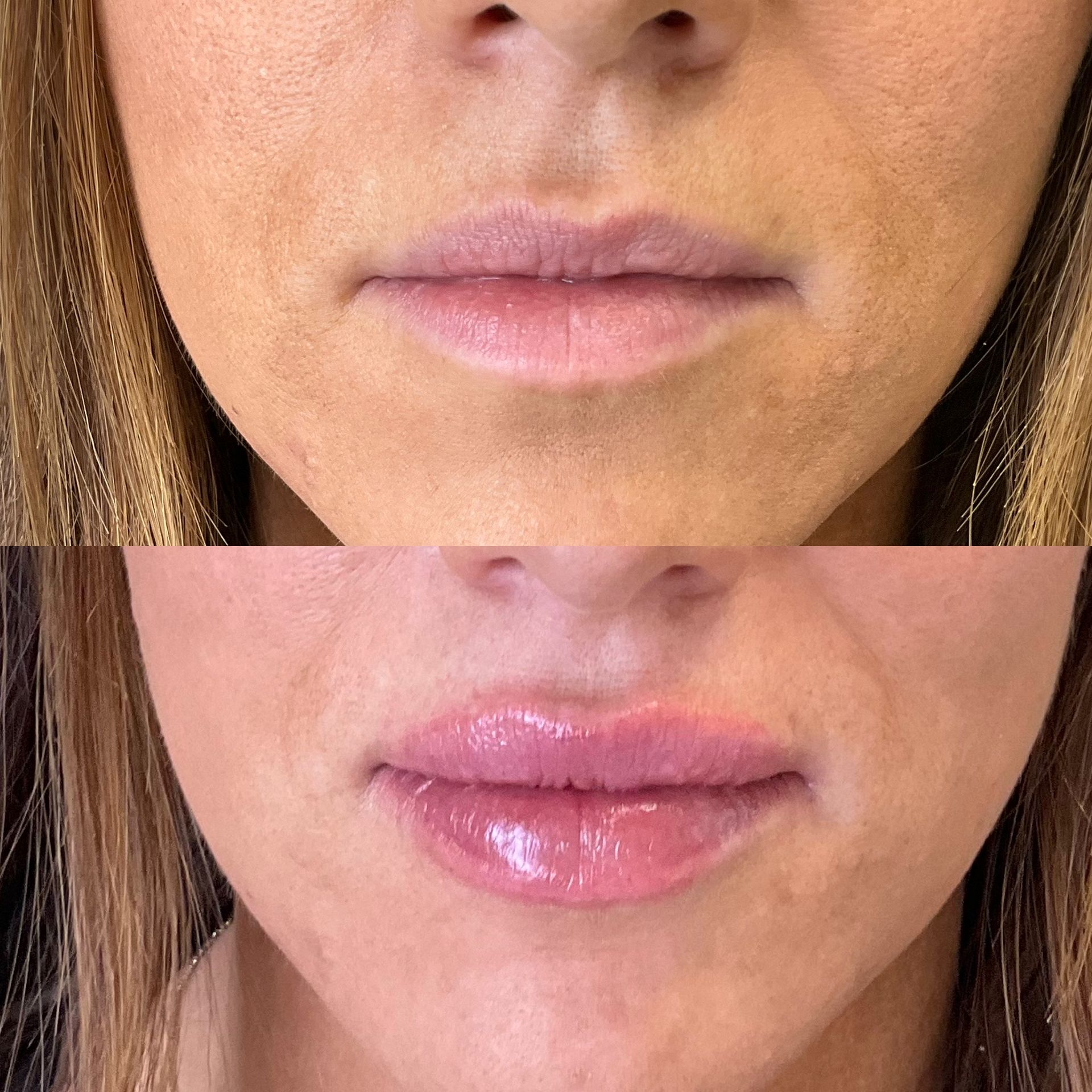 A before and after photo of a woman 's lips.