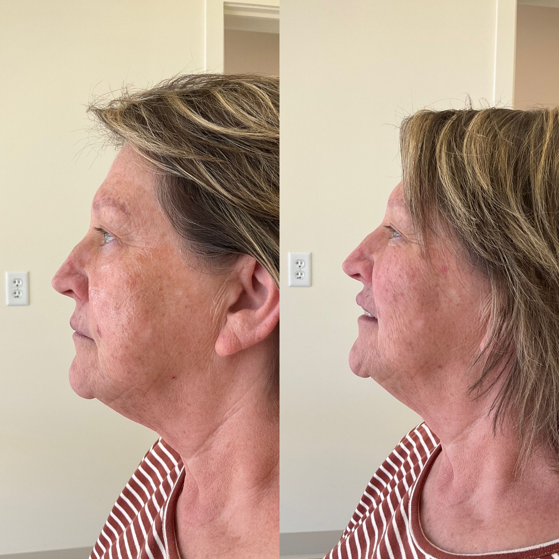 A before and after photo of a woman 's face