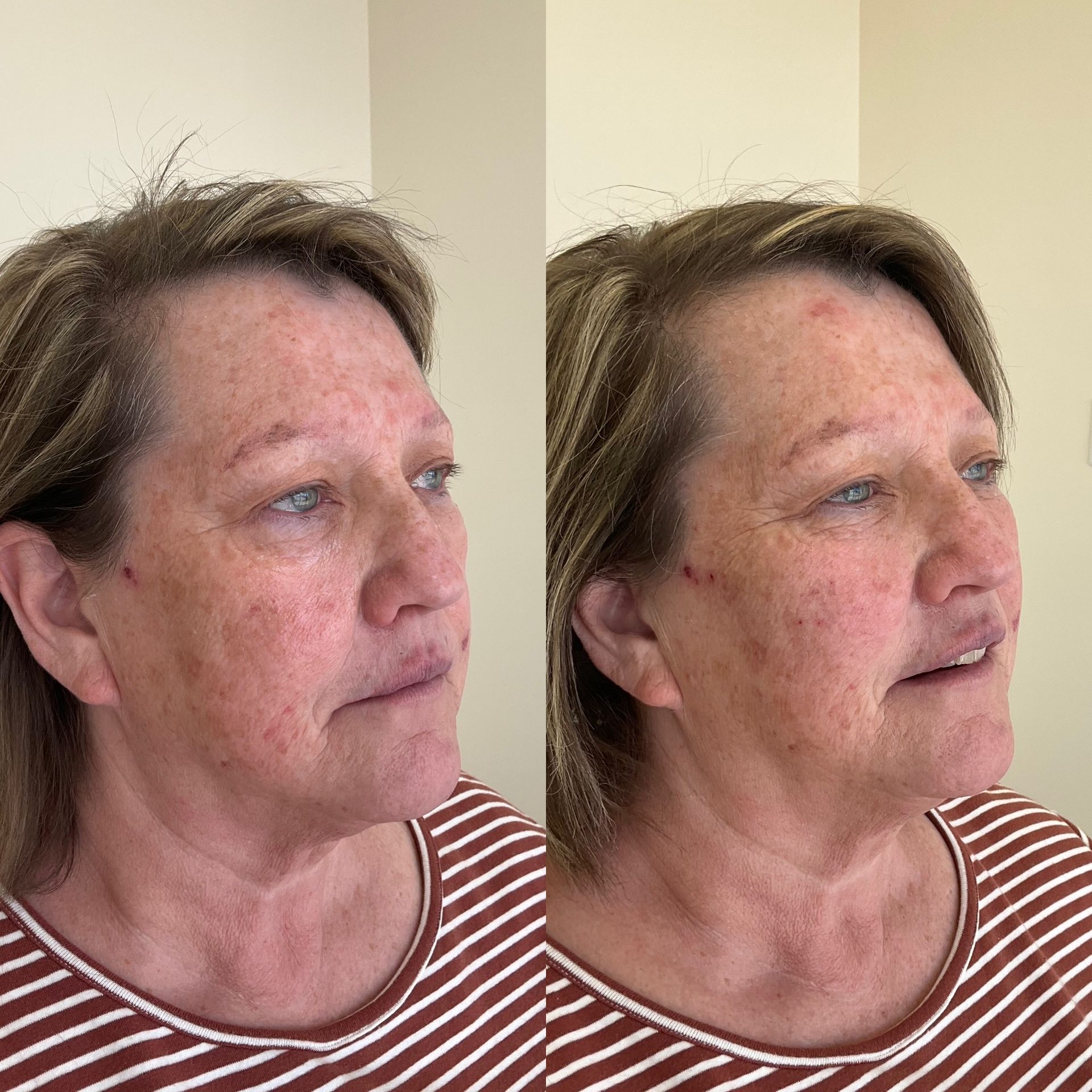 A before and after photo of a woman 's face.