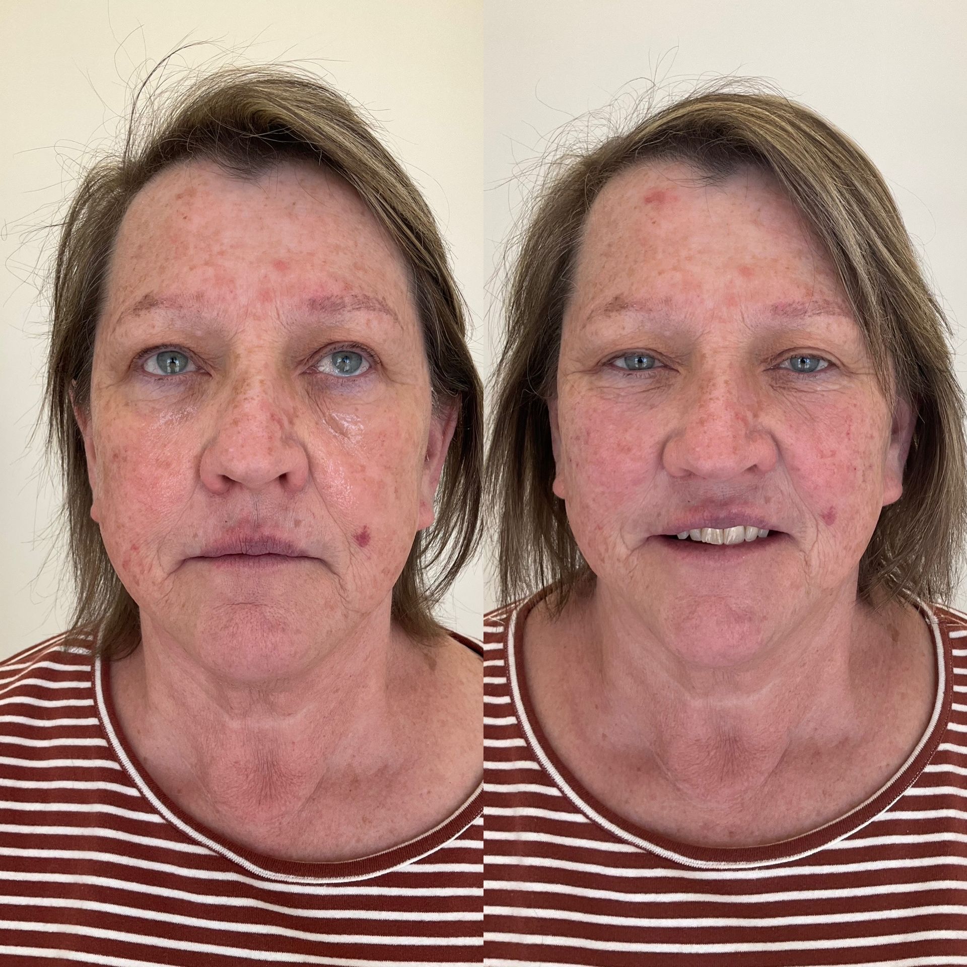 A before and after photo of a woman 's face.