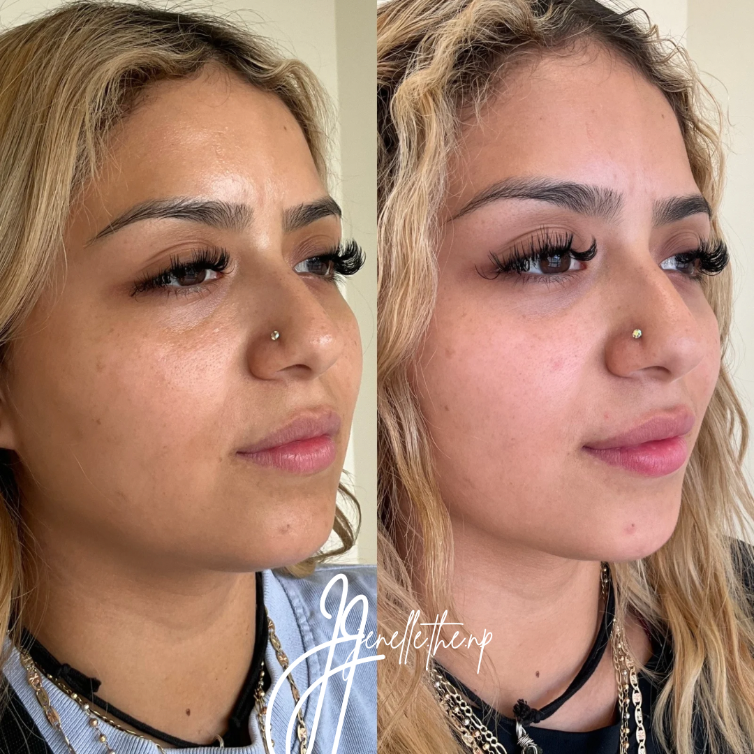 A before and after photo of a woman 's face.