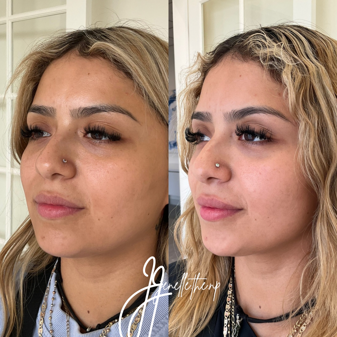 A before and after photo of a woman 's face.