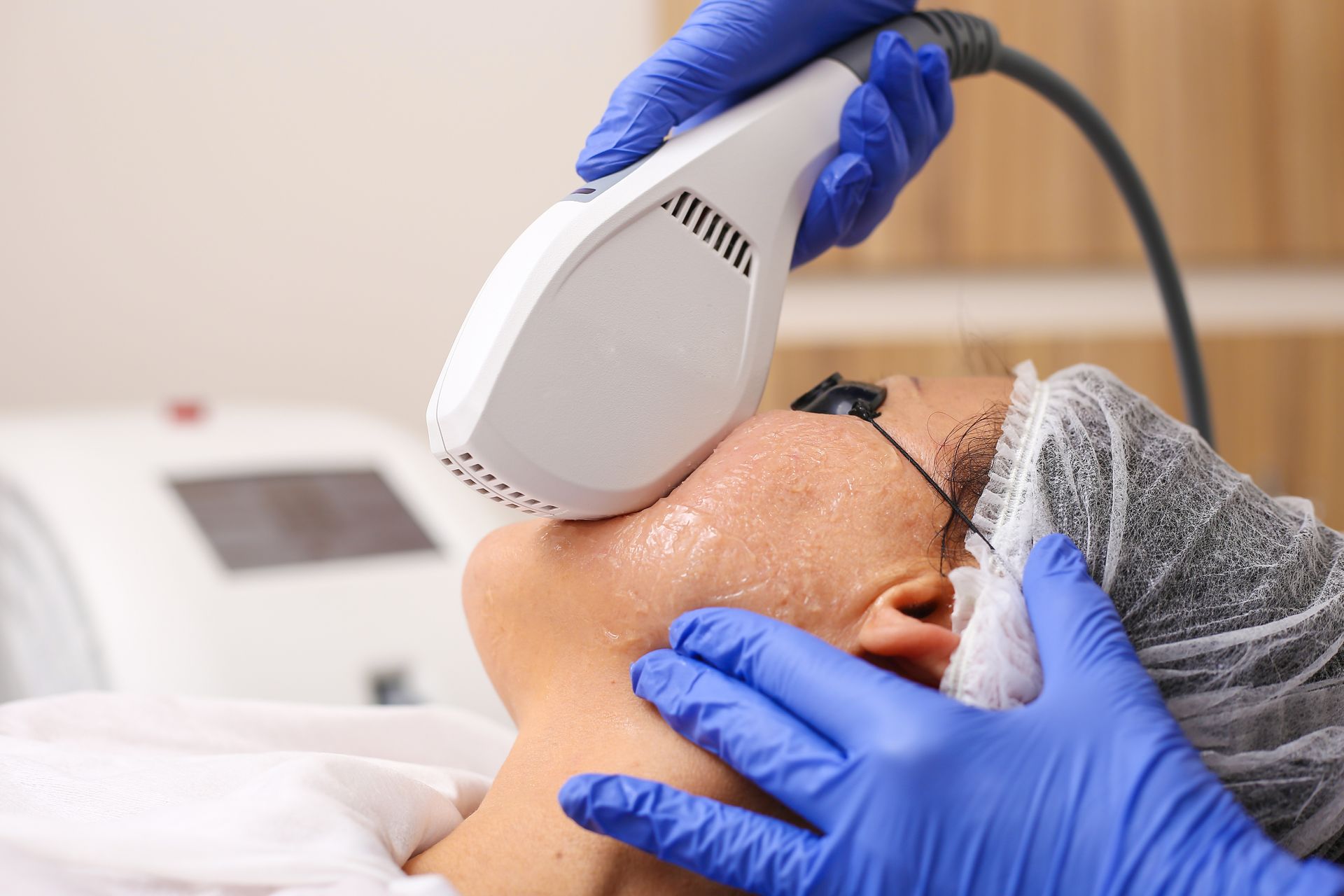 A woman is getting a laser treatment on her face.