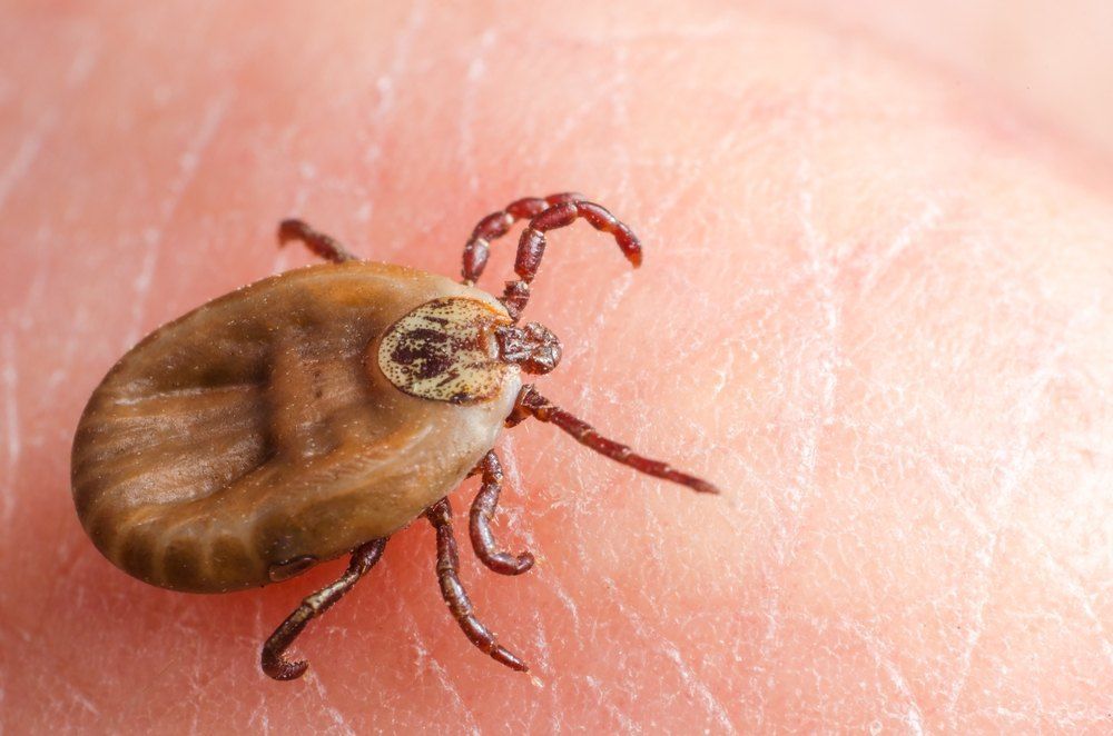 Tick Embedded in Human Skin — Optimum Pest Services In Atherton, QLD