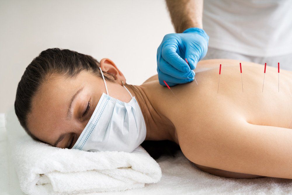 Acupuncture Treatment — Miranda, NSW — Pinpoint Physiotherapy and Sports Medicine