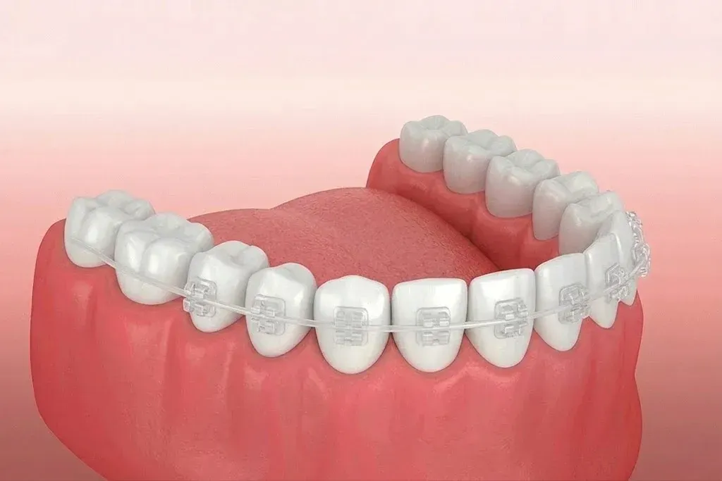 dental implants in simpsonville | upstate smiles