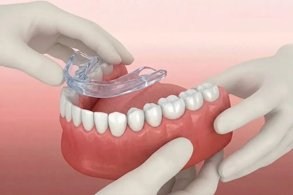 dental implants in simpsonville | upstate smiles