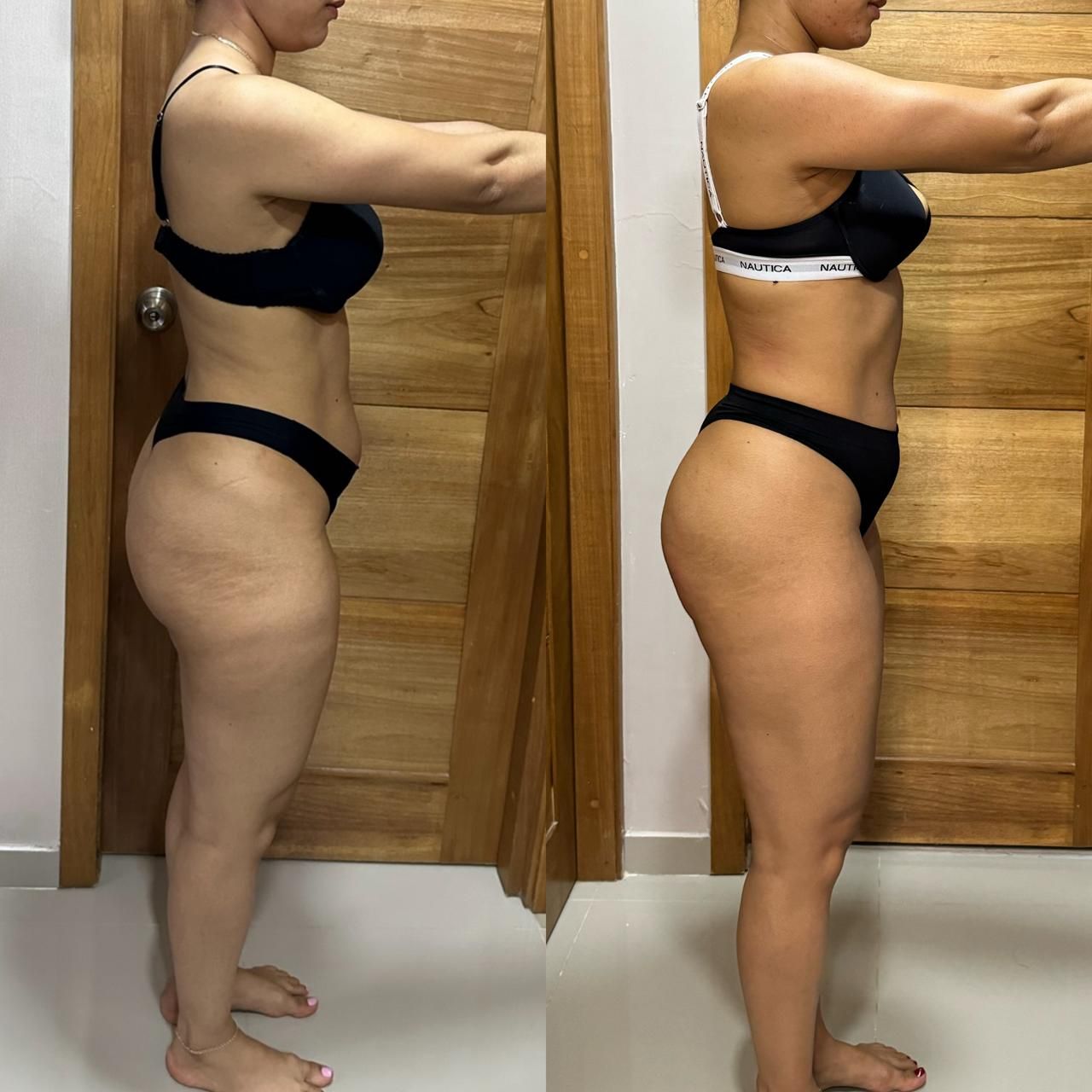 Side-by-side profile photos of a person in black underwear showing a body transformation.