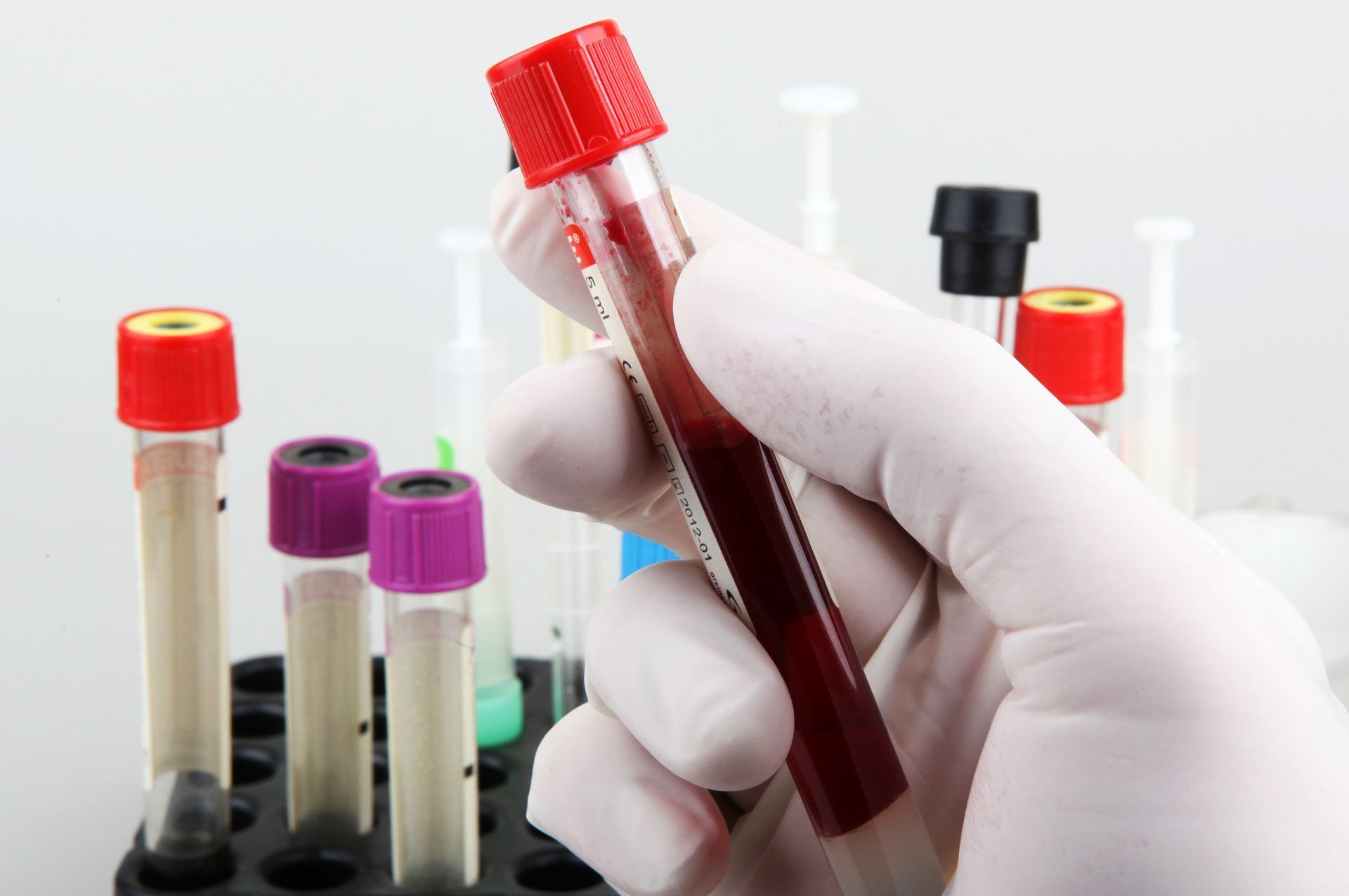 Kube Medical | Blood tests